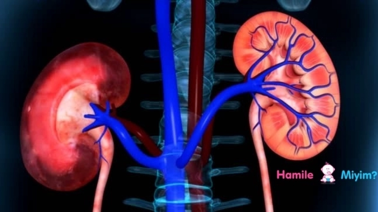 Böbrek kanseri nedenleri belirtileri ve tedavisi