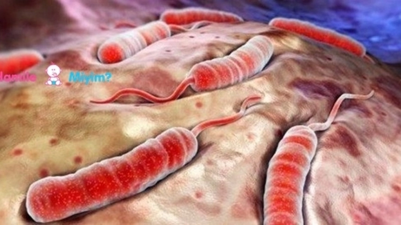 Kolera nedenleri belirtileri ve tedavisi