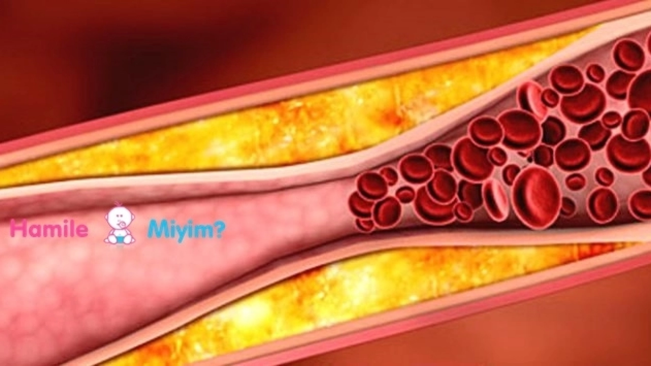 Kolesterol nedenleri belirtileri ve tedavisi