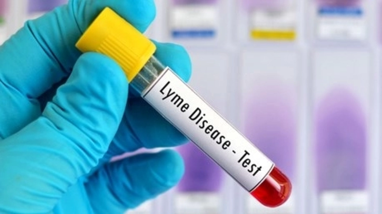 Lyme hastalığı nedenleri belirtileri ve tedavisi