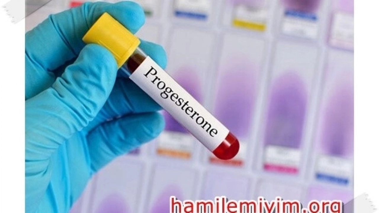 Progesteron testi hakkında bilmeniz gerekenler