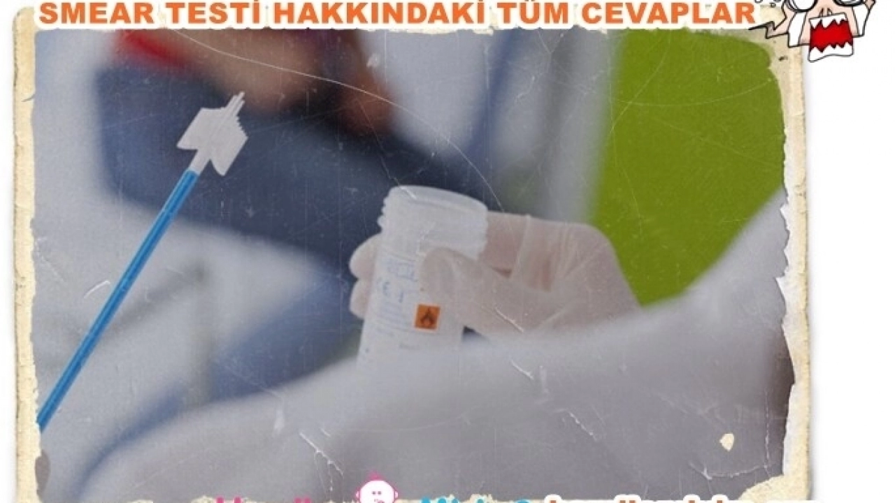 Smear testi yaptıranlar tüm merak edilenleri yazdık