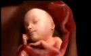 Hamileliğin ve bebeğin ilk oluşumu video şeklinde