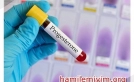 Progesteron testi hakkında bilmeniz gerekenler