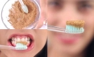 Evde doğal yollarla diş beyazlatma yöntemi