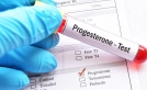 Progesteron değerleri ne olmalı kaç olmalı 21 gün testi değerleri hakkında bilgiler ?