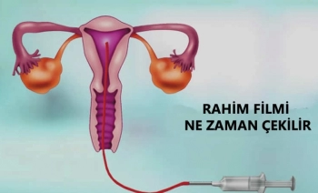 Hsg sonrası hamile kalama oranı nedir ?