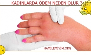 Kadınlarda ödem neden olur nasıl atılır ?