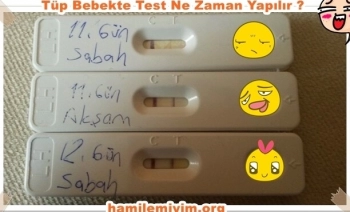 Tüp bebekte gebelik testi (hamilelik) testi ne zaman yapılır?