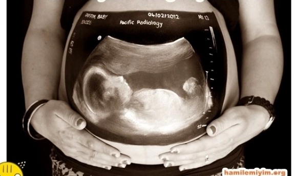 Hamileyken Röntgen Çektirenlere Tavsiyeler