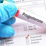 Progesteron değerleri ne olmalı kaç olmalı 21 gün testi değerleri hakkında bilgiler ?