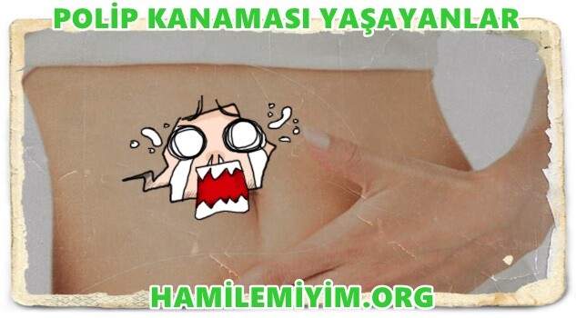 polip kanaması nedenleri kaç gün sürer