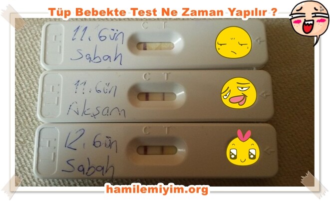 tüp bebek kadınlar kulübü