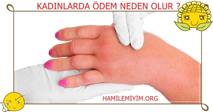 kadınlarda ödem kadınlar kulübü