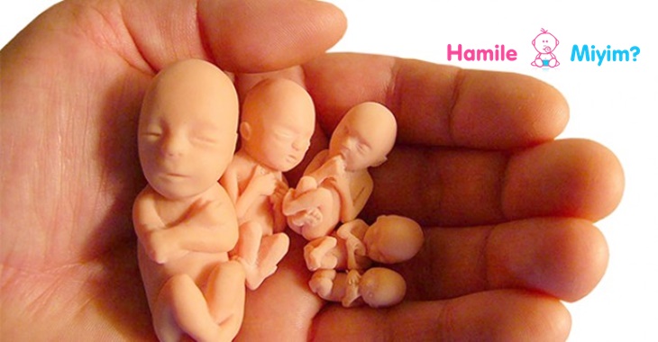 Düşük sonrası görülen komplikasyonlar Kadınlar Kulübü Hamilemiyim